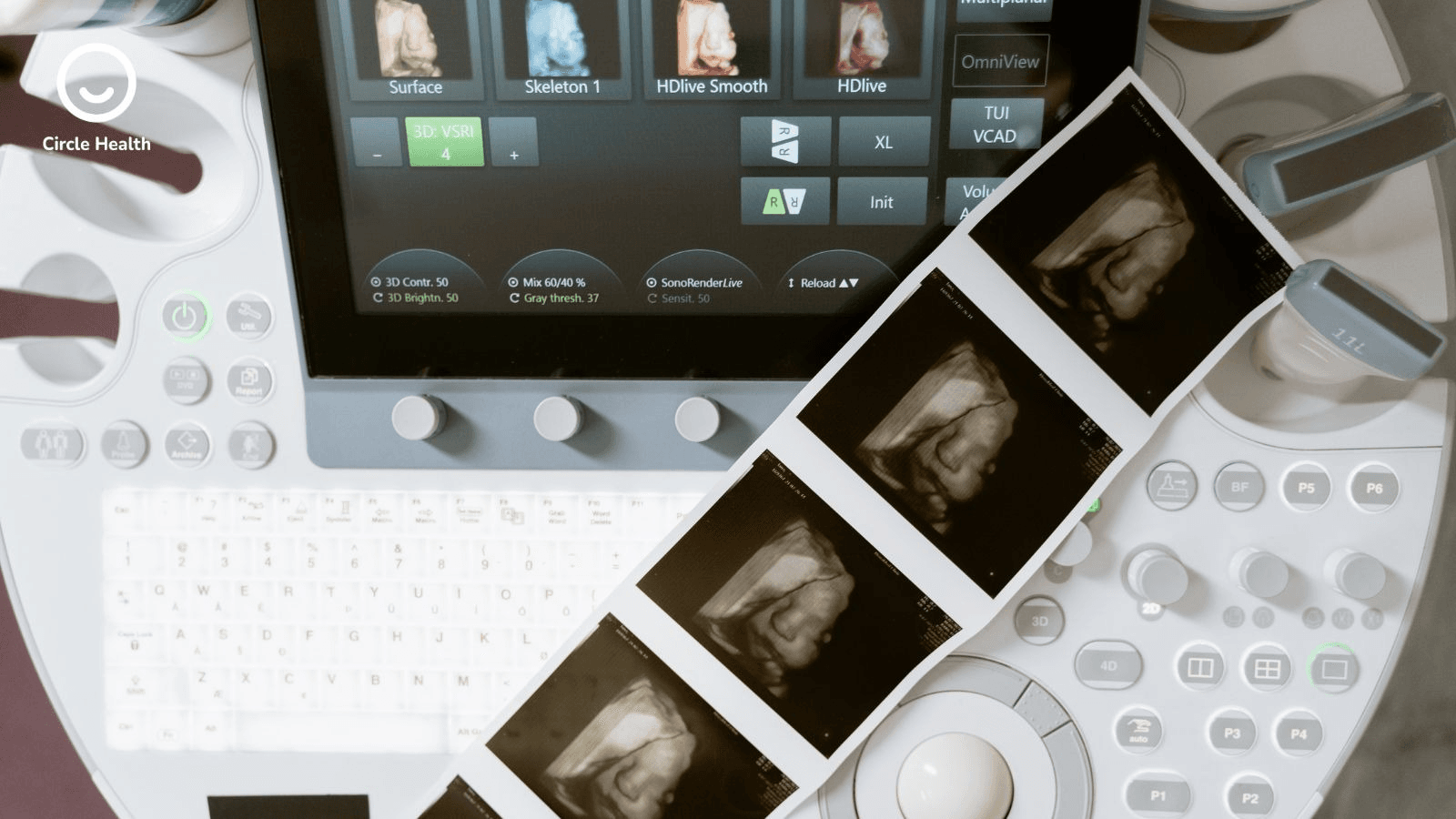 Where Ultrasound Billing Connects to Broader Chronic Care Management